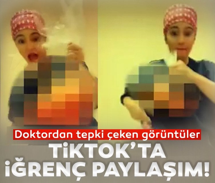 Brezilyalı cerrahtan TikTok’ta mide bulandıran paylaşım!