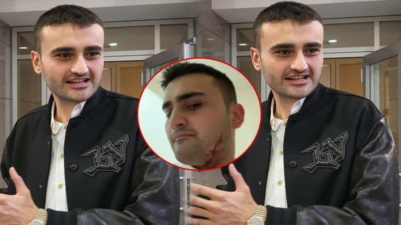 CZN Burak'ın yaralı halleri korkutmuştu! CZN Burak'tan videoyla ilgili ilk açıklama