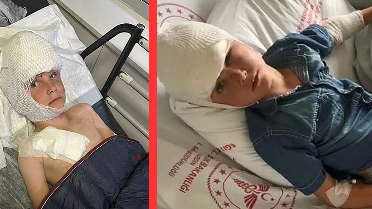 Mardin’de  köpek dehşeti: 7 yaşındaki Bilal başından ve kolundan yaralandı!